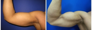 biceps2