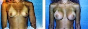 257