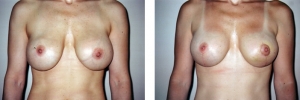 1006