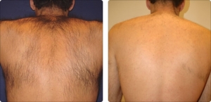 soprano_back_2